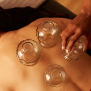 Hijama Cupping